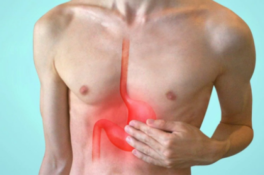Reflusso gastroesofageo: come riconoscerlo e affrontarlo Reflusso gastroesofageo: come riconoscerlo e affrontarlo